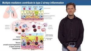 Part 2: Asthma heterogeneity: biomarkers and drug development