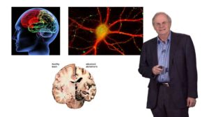 Part 1: Neurodegenerative disease: The Coming Epidemic
